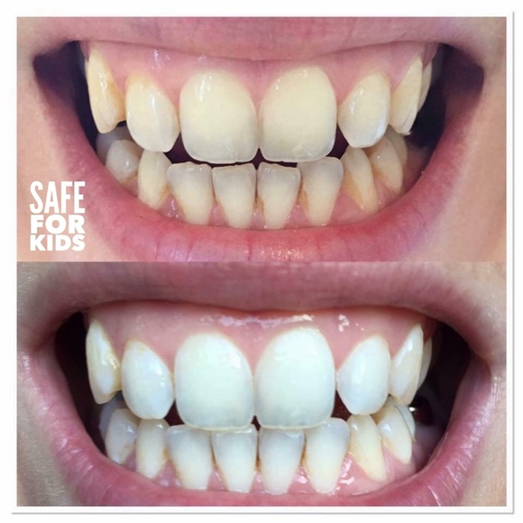 Whitening Toothpaste - Picture 2 of 16